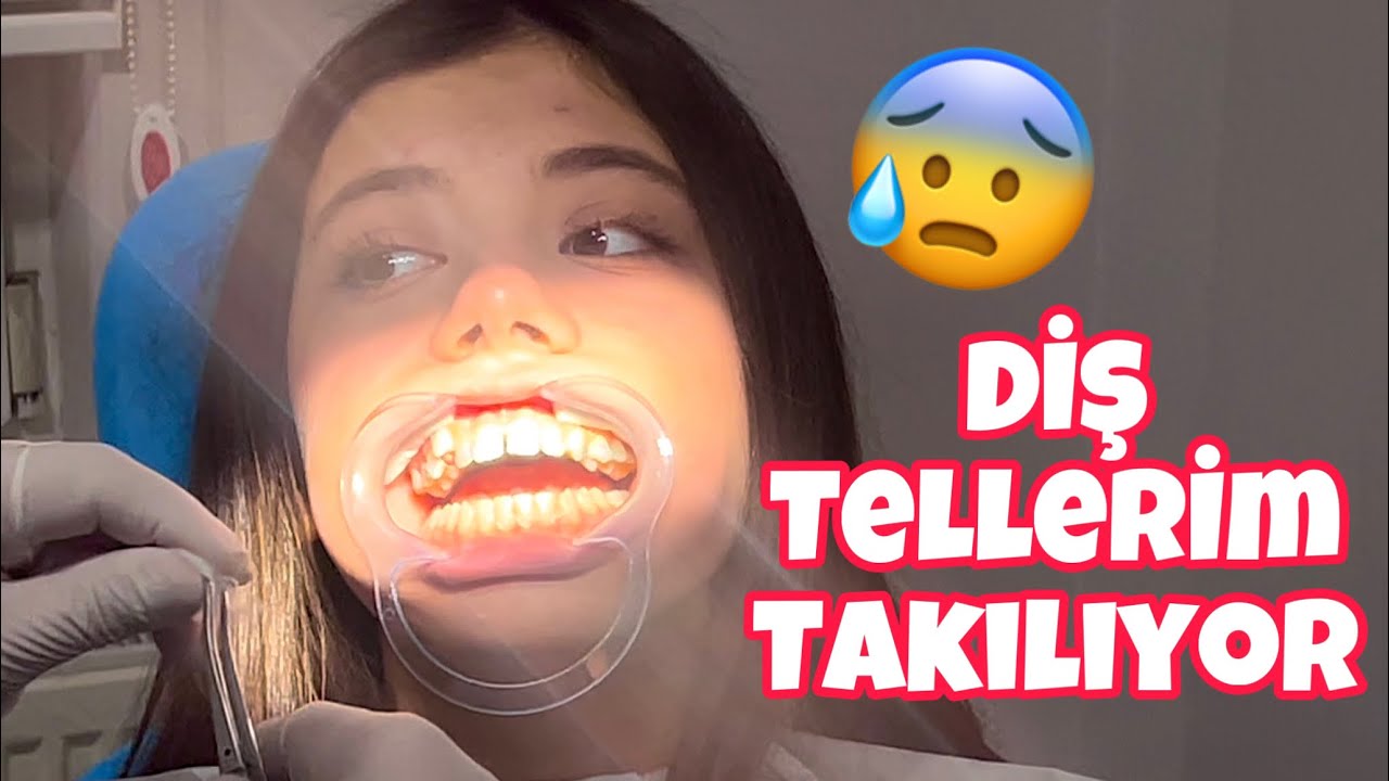 DİŞ TELLERİM TAKILIYOR !! VLOG @TuanaZeybek