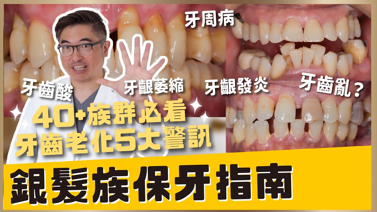 【牙齒保健 #13】醫師揭密！牙齒老化5大警訊｜40+族群必看保牙指南｜【祐民牙醫－隱適美旗艦店】鑽石級楊大為醫師