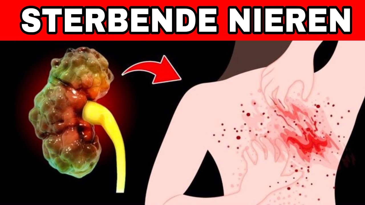 9 Warnzeichen, die dein K&ouml;rper gibt, bevor deine Nieren STERBEN + 8 Wege, sie jetzt zu sch&uuml;tzen