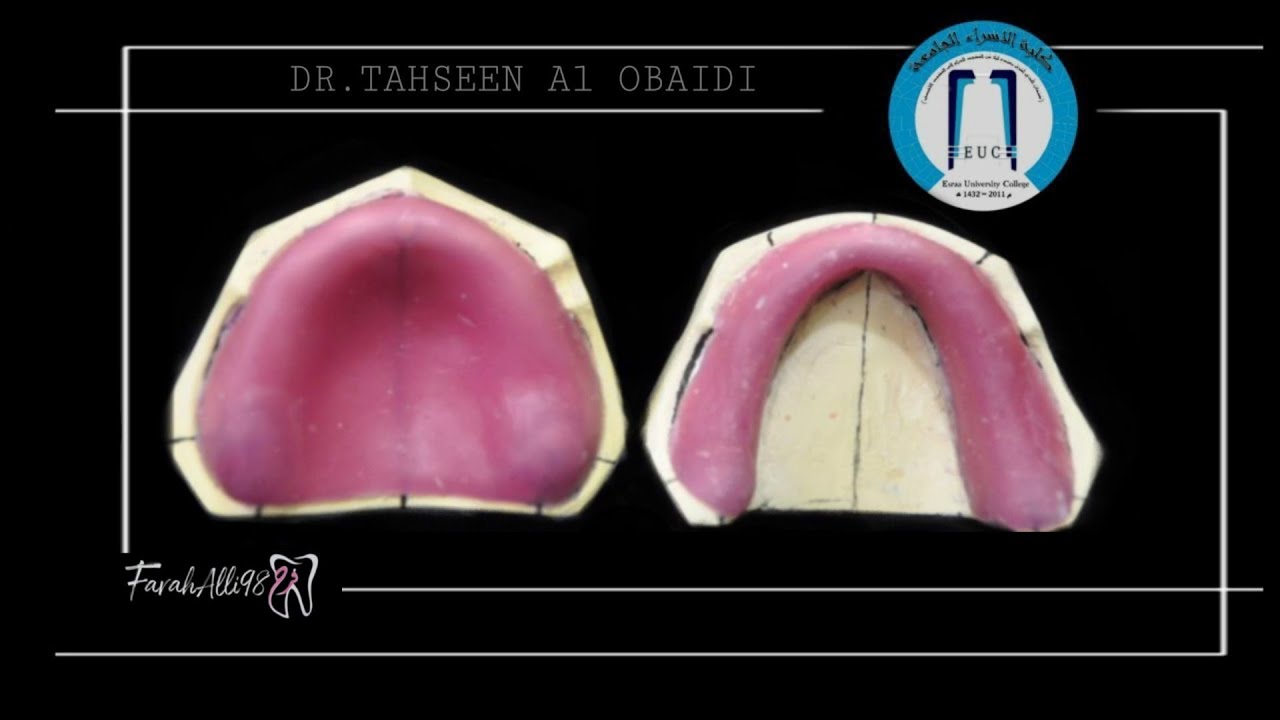 Part 2 | كيفية عمل Primary Casts,Record base على الفاينال كاستComplete Dentureجزء الثاني#FarahAlli98