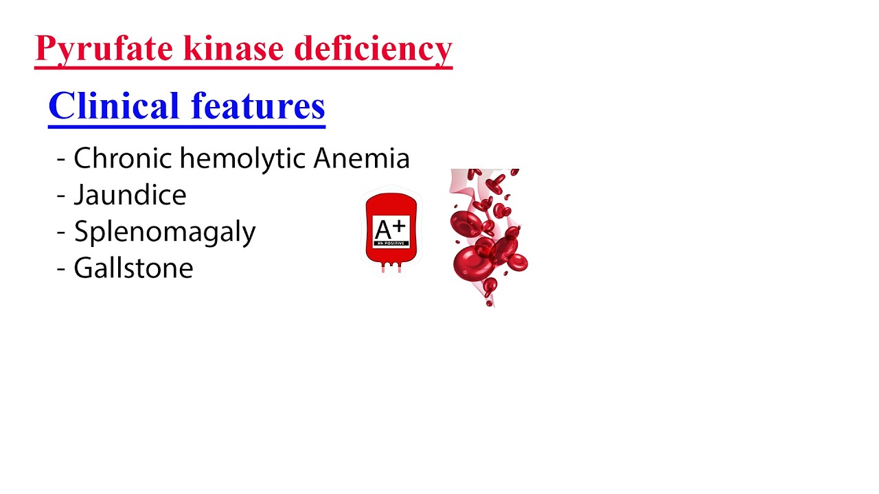 #Cashirki 5aad I Clinical features of pyruvate kinase deficiency