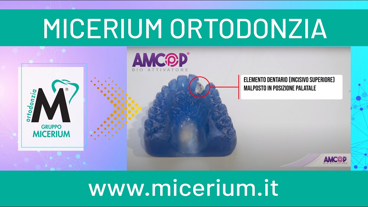 AMCOP - Perfezionamento dispositivo