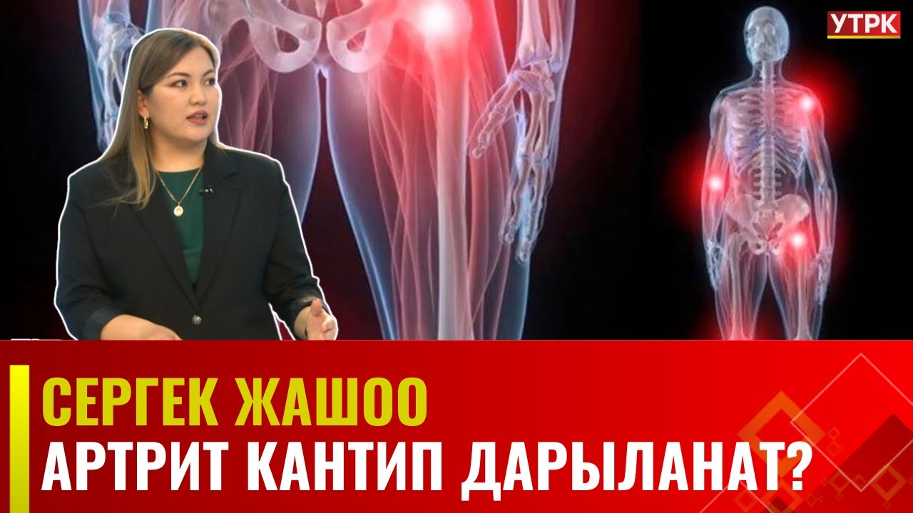 Артрит кантип даарыланат?