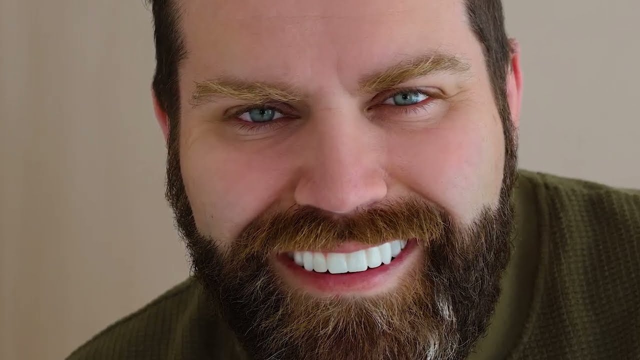 Alex's @DiceandDragonsOfficial All-on-X Dental Implant Journey