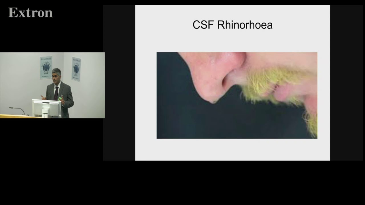 Nasal Emergencies