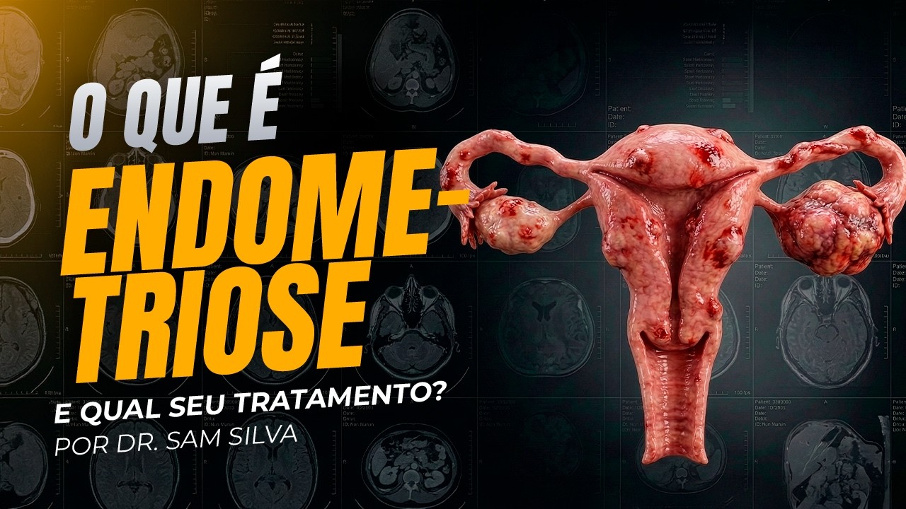 O que é ENDOMETRIOSE e como TRATAR?