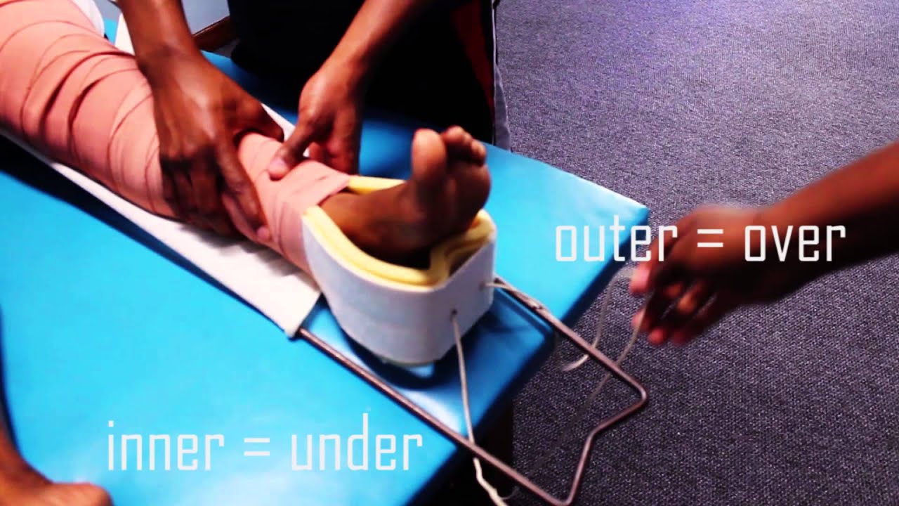 How to Apply a Thomas Splint