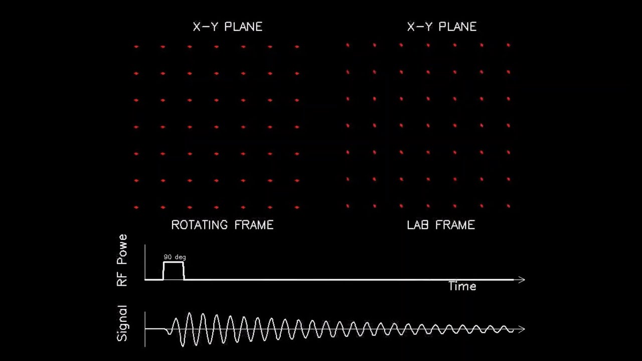 MRI: Physics and Image Creation - Spin Lattice Relaxation (Part 7/18)