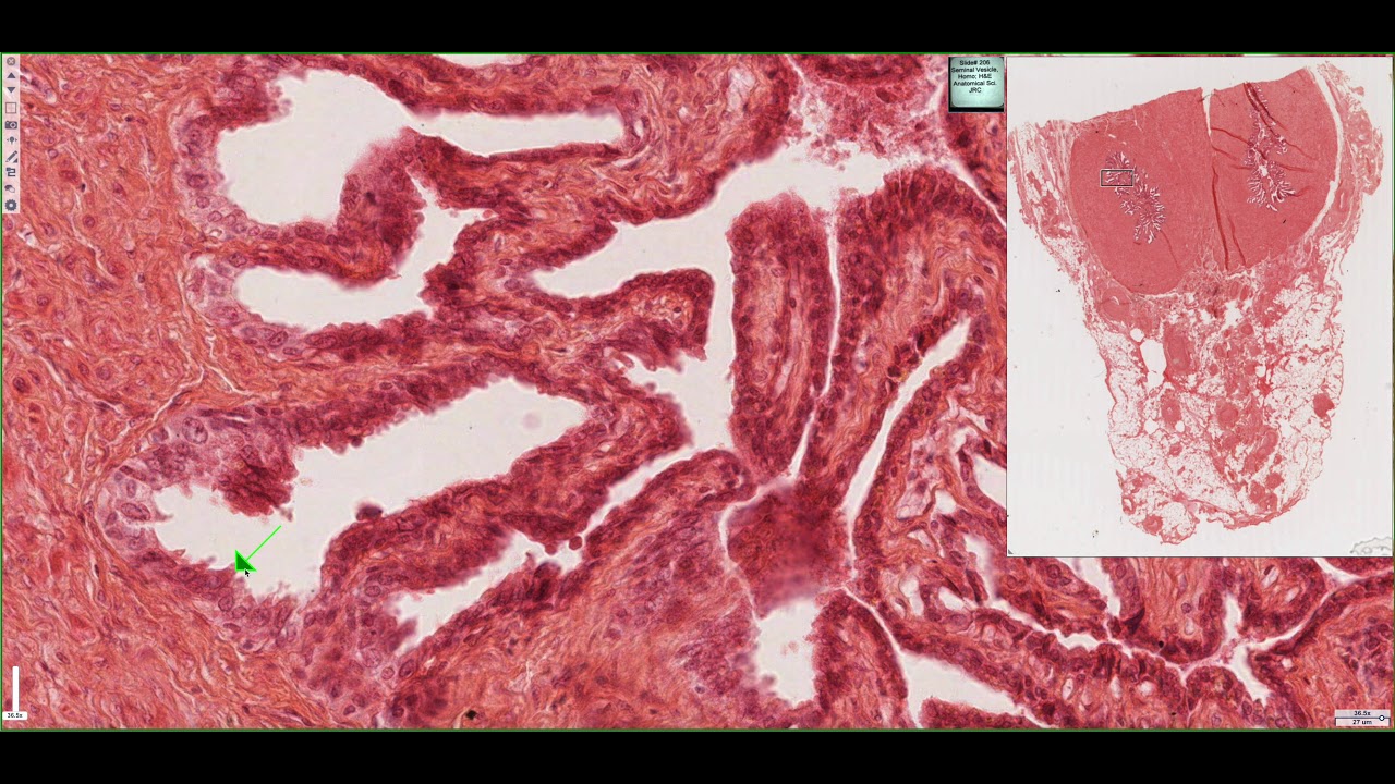 Histology of the Seminal Vesicles 4K