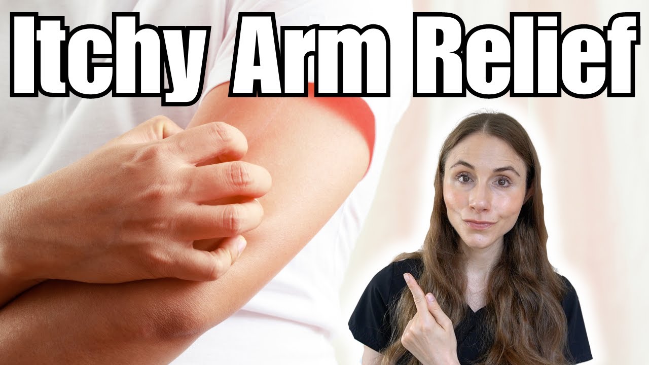 How To Relieve Itchy Arms | Brachioradial Pruritus