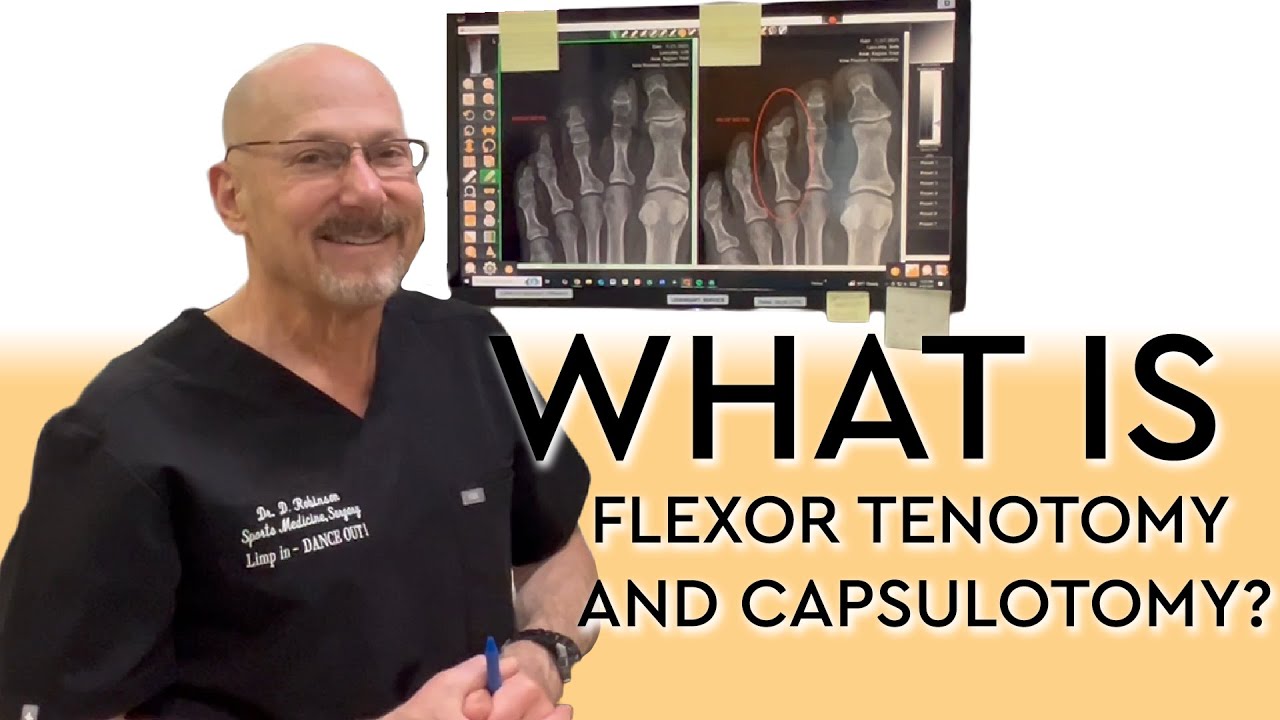 What is Flexor Tenotomy and Capsulotomy?