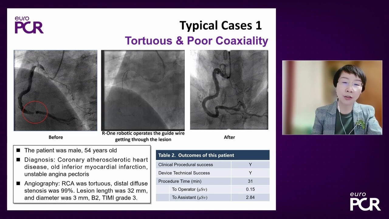 Embrace the innovation in PCI and TAVR - EuroPCR 2022