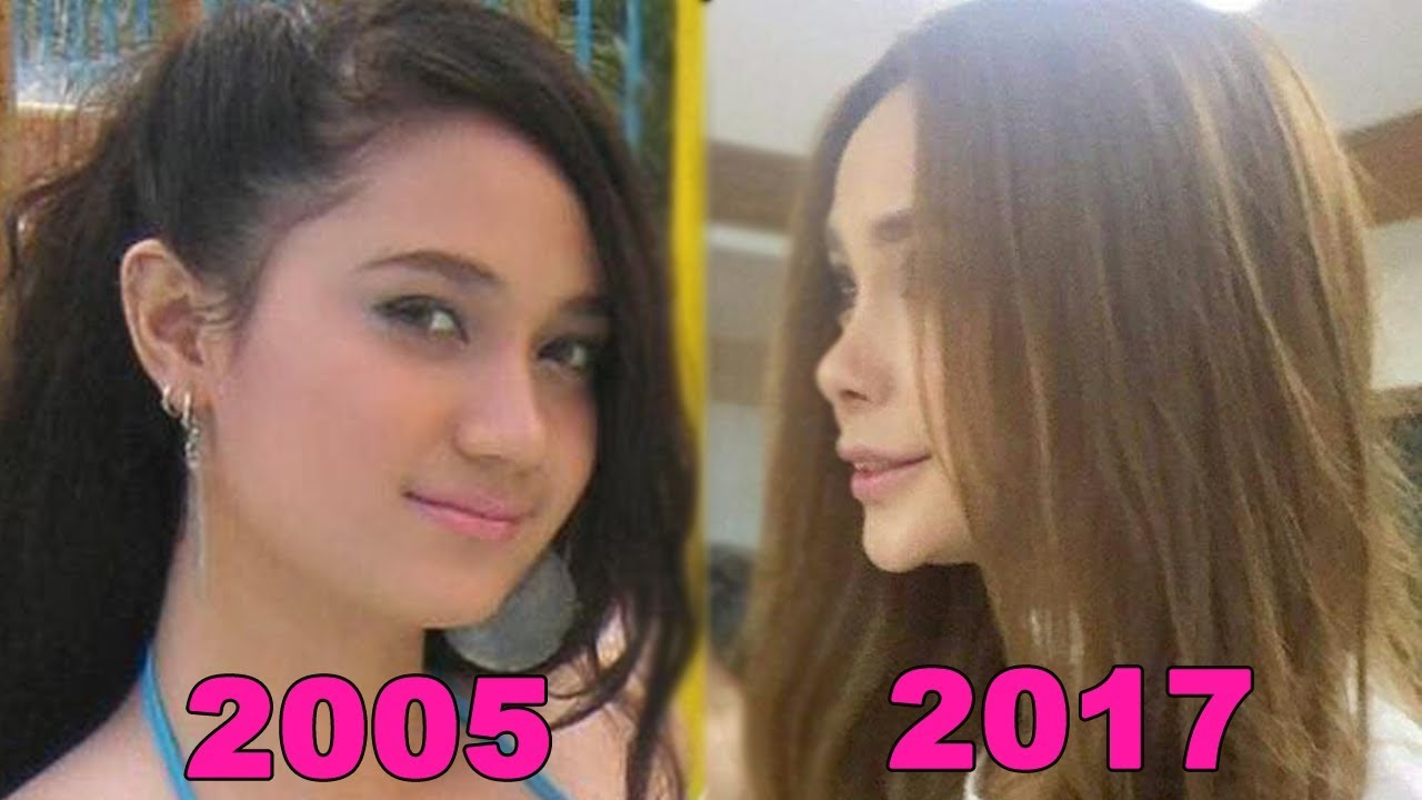 ARCI MUNOZ PLASTIC SURGERIES THROUGH THE YEARS