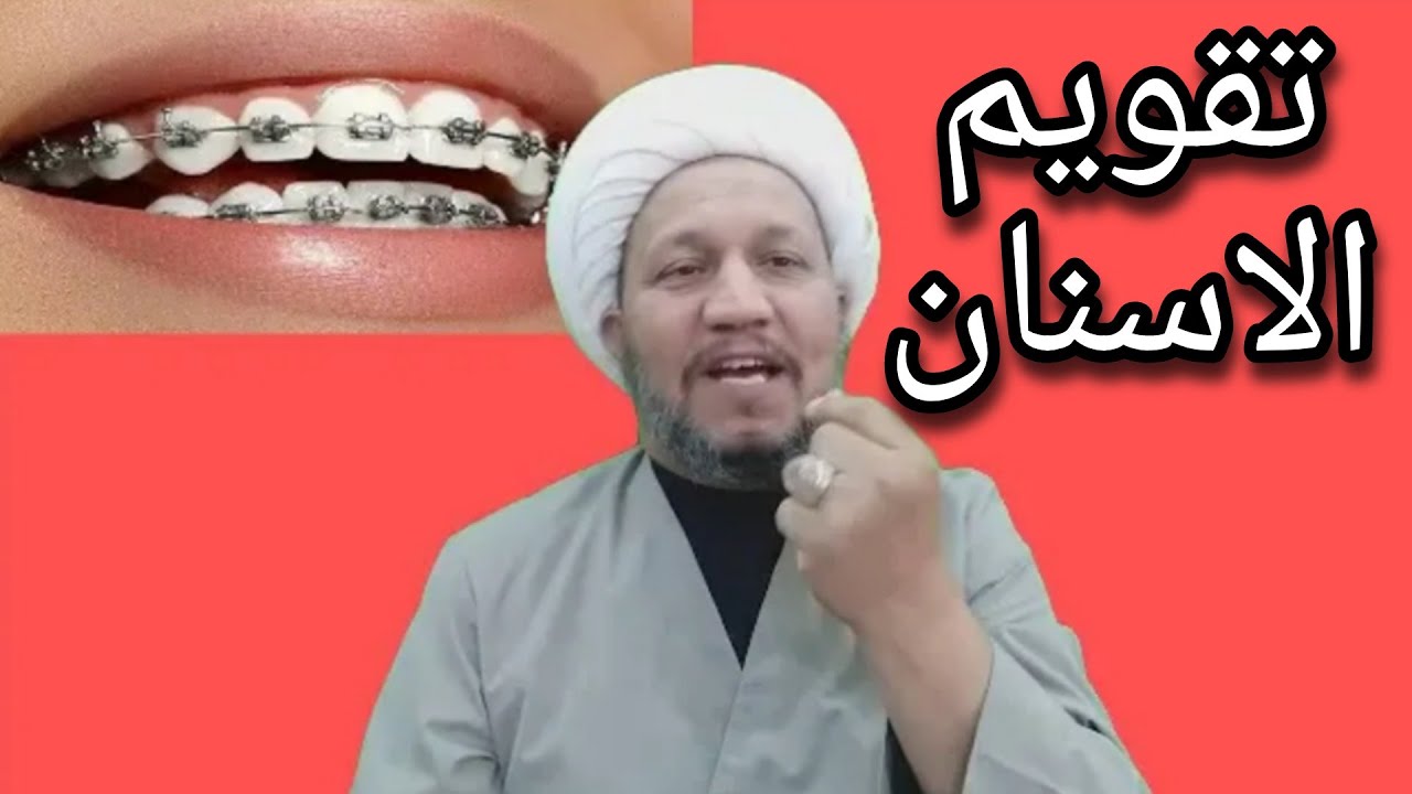تقويم الأسنان حلال أم حرام ؟ وحكم الصلاة بالمكياج