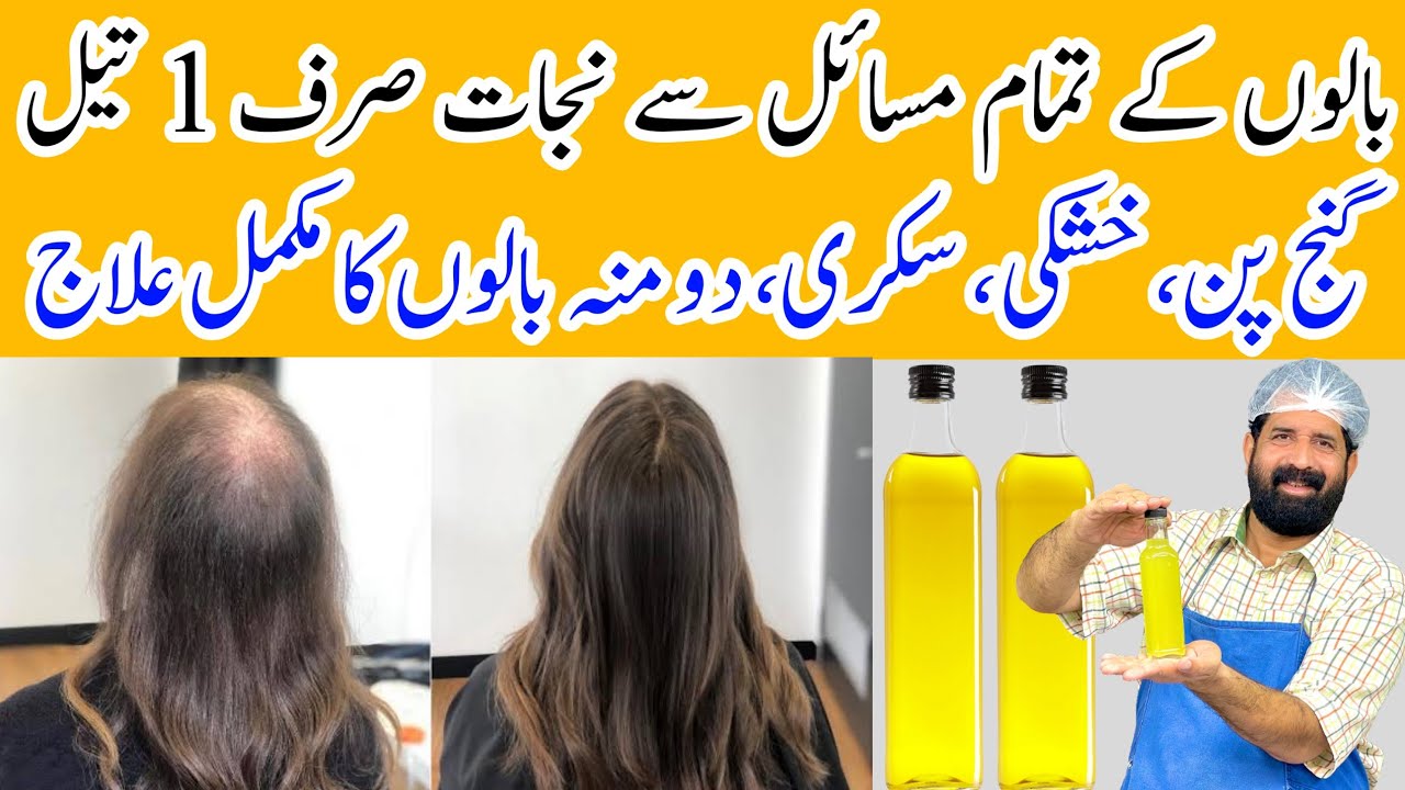Stop 🖐 Hair Fall 100% | Faster Growth Magical Onion Oil at Home | BaBa Food RRC