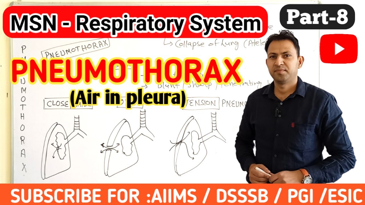 Pneumothorax | causes symptoms pathophysiology treatment of pneumothorax | respiratory msn (part-8)