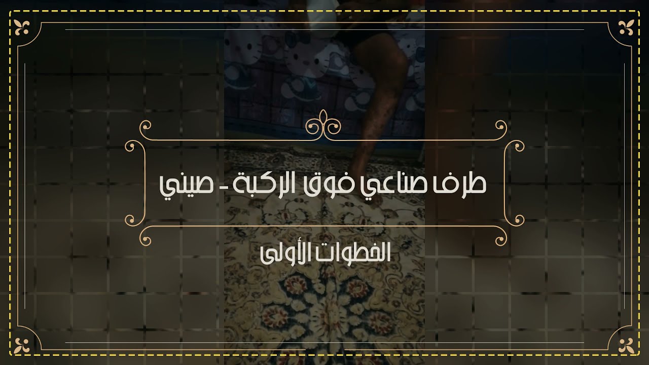الطريقة الصحيحة لارتداء الطرف الصناعي فوق الركبة | طرف صناعي بحزام جلد