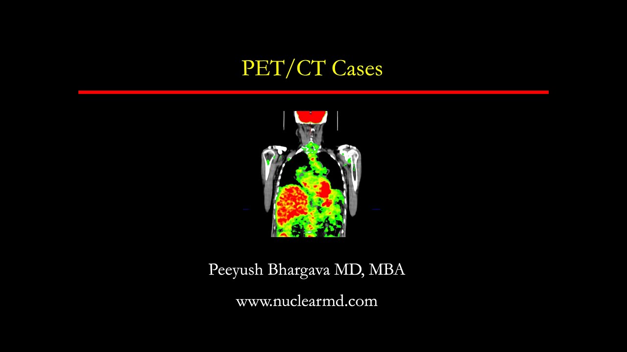 PET/CT Cases