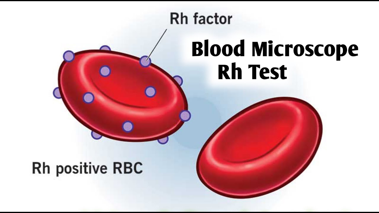 Blood Group Test in Hindi