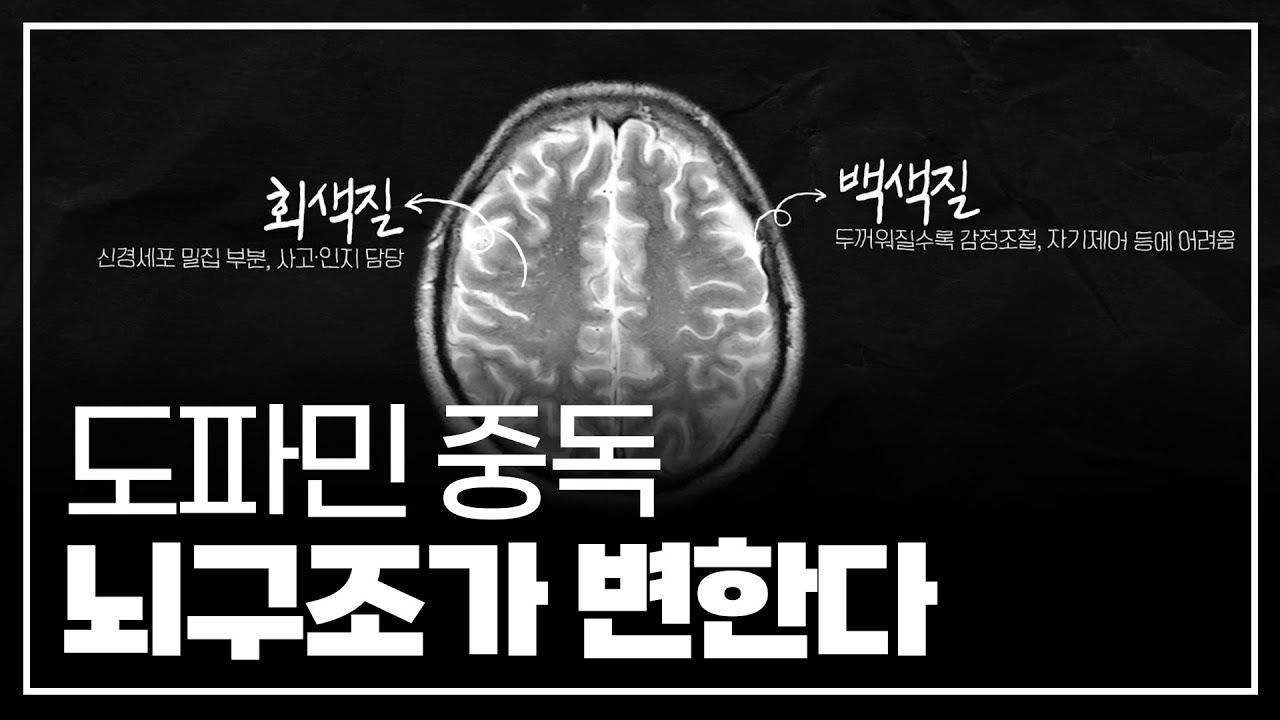 마약 수준의 중독성 숏폼ㅣ뇌가 쉬지 못하면 벌어지는 일ㅣ팝콘브레인ㅣ지식핫플