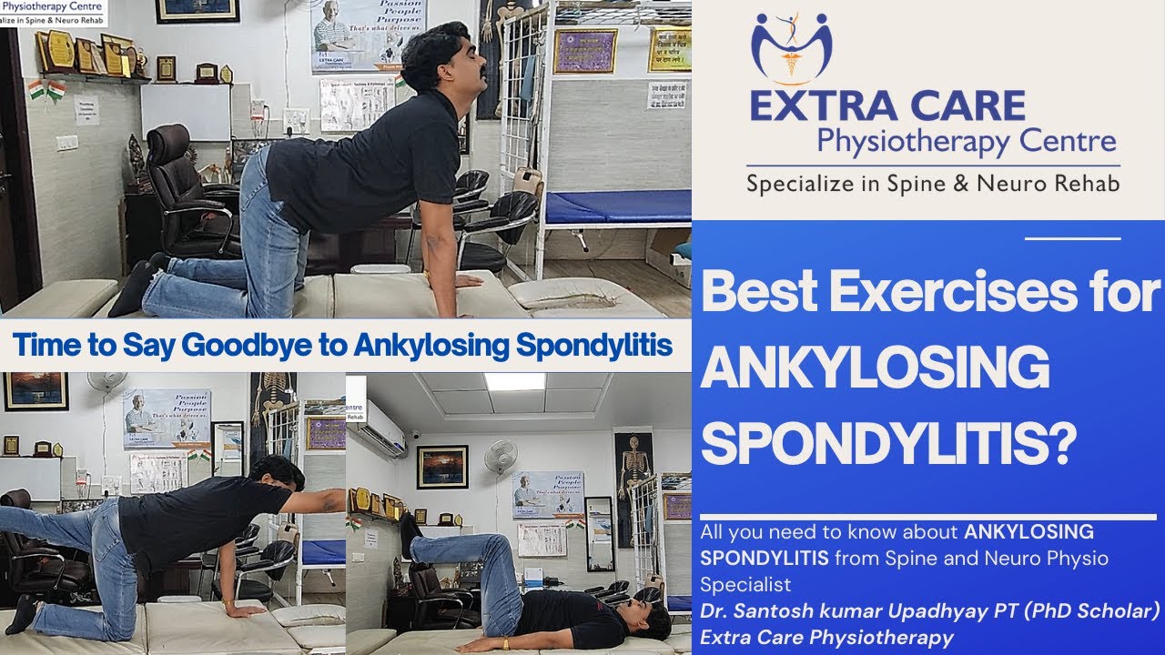 Ankylosing Spondylitis Exercises in Hindi |  स्पॉन्डिलाइटिस का कैसे करें जड़ से इलाज | AS in Hindi