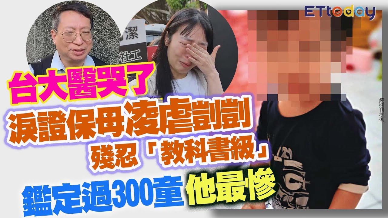 台大醫哭了　淚證剴剴保母殘忍「教科書級」　鑑定過300童他最慘
