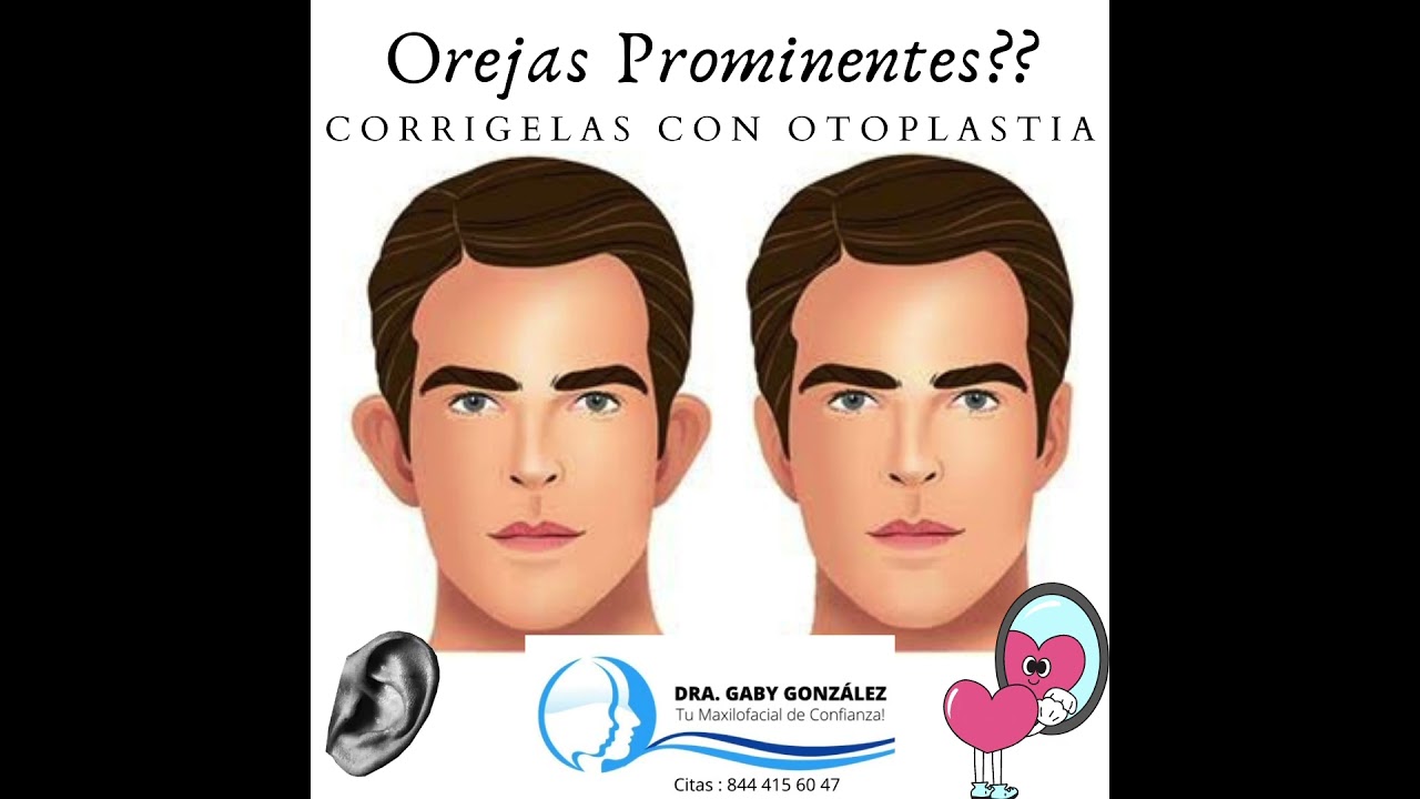 Otoplastia Saltillo / Cirug&iacute;a para Correcci&oacute;n de Orejas Prominentes