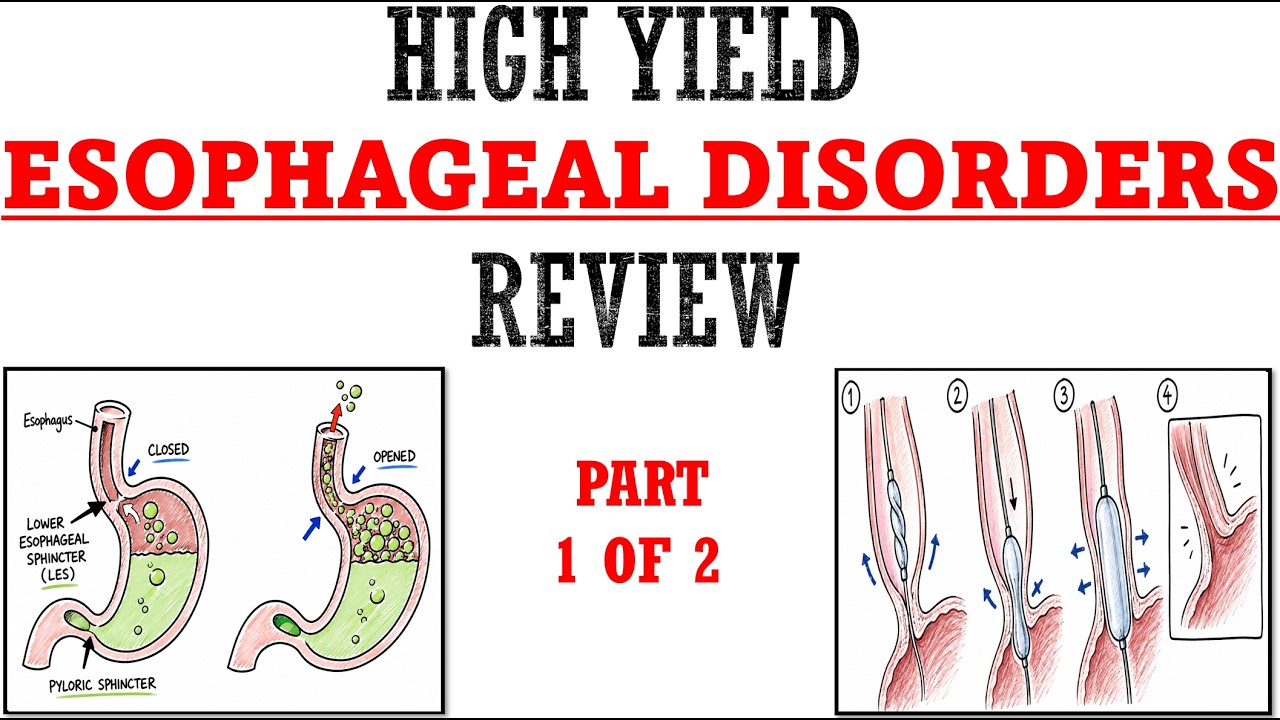 Esophageal Disorders part 1 of 2 Review | Mnemonics And Proven Ways To Memorize for your exams!