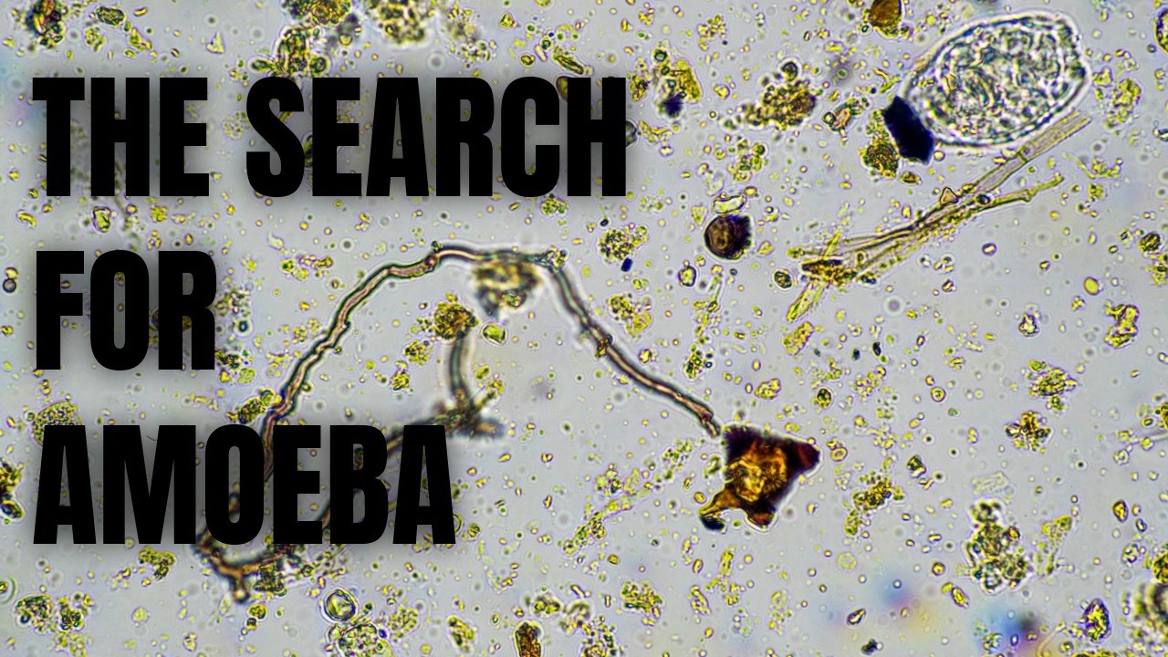Where The Amoebas At