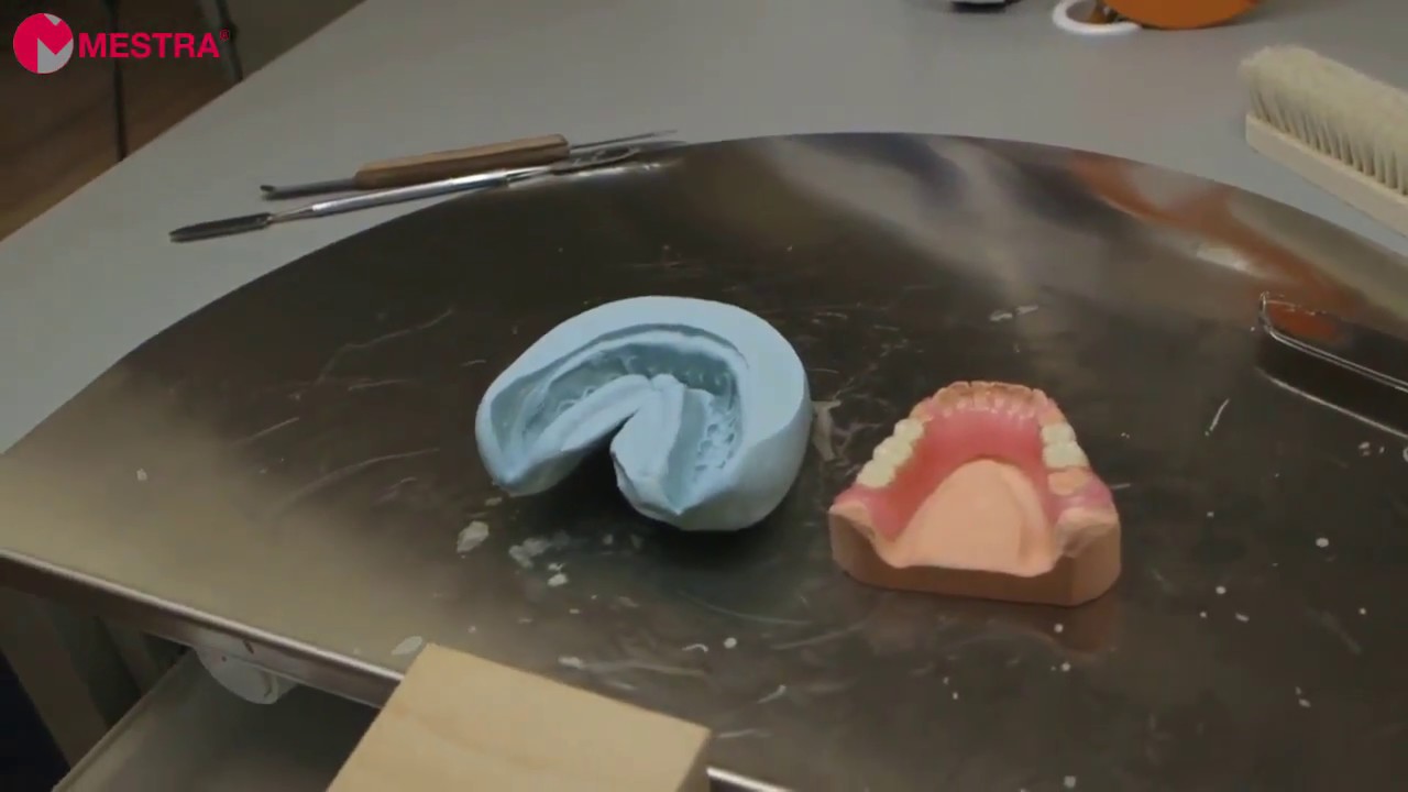 PROSTHESIS DENTAL PREPARATION WITH Q-DENT ACRYLIC