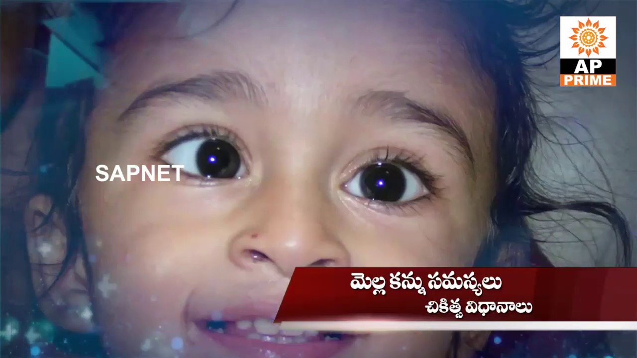 Health Guide | Lazy eye (amblyopia) Treatment | EP 58 | AP Prime Tv | SAPNET