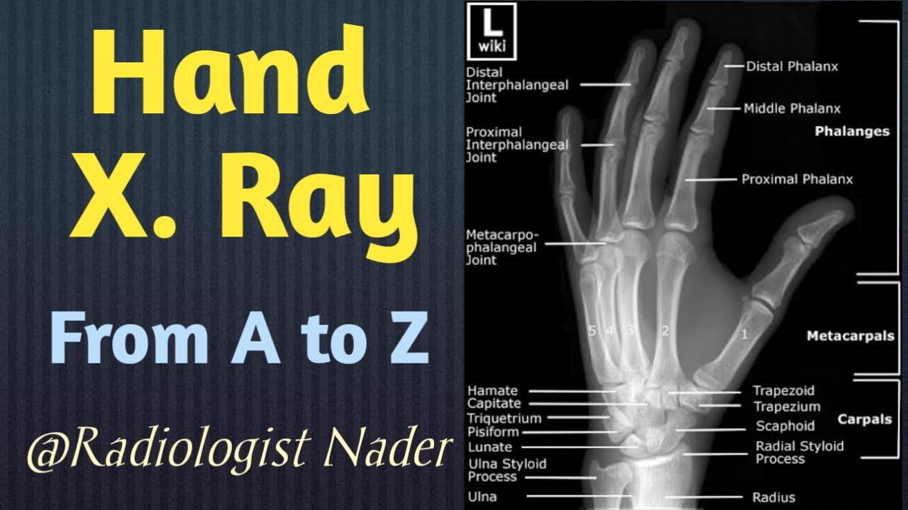#اوضاع_الاشعة_العادية علي #اليد_والاصابع |      X_Ray #hand and #fingers #positions#