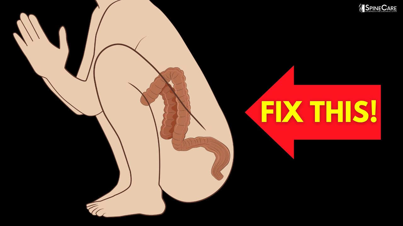 How to Instantly Relieve Constipation (POOP NOW!)