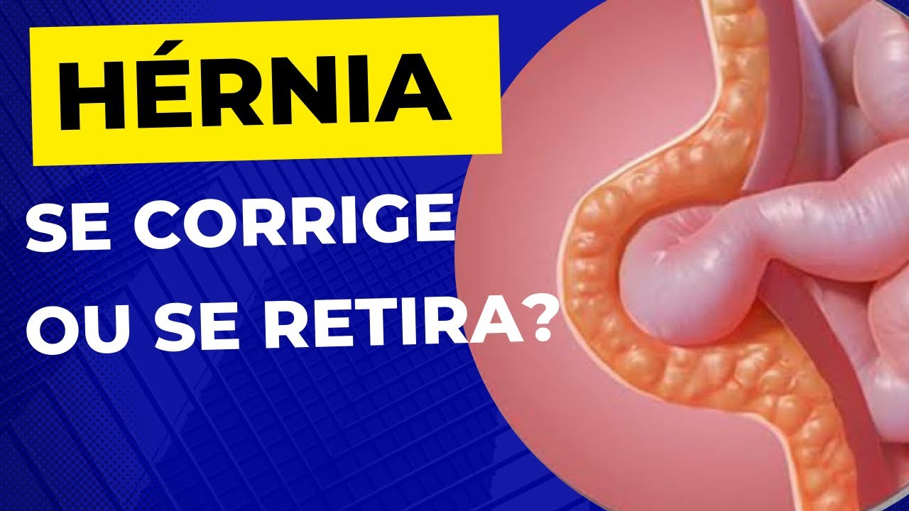 Como &eacute; a CIRURGIA DE H&Eacute;RNIA? A h&eacute;rnia &eacute; retirada ?