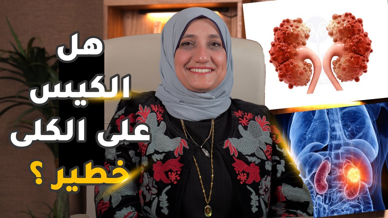 هل الكيس على الكلى خطير ؟