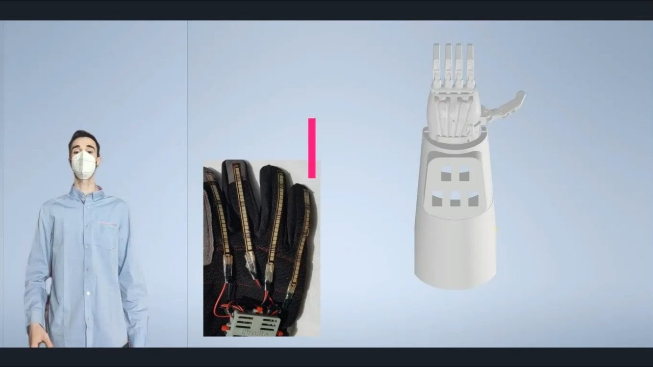 Pr&oacute;tesis de mano rob&oacute;tica