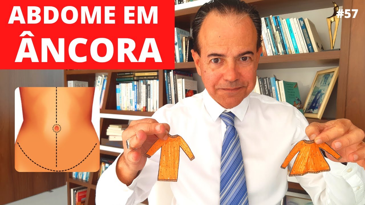 ABDOME EM ÂNCORA | ABDOMINOPLASTIA EM T [ Cirurgia Plástica ]