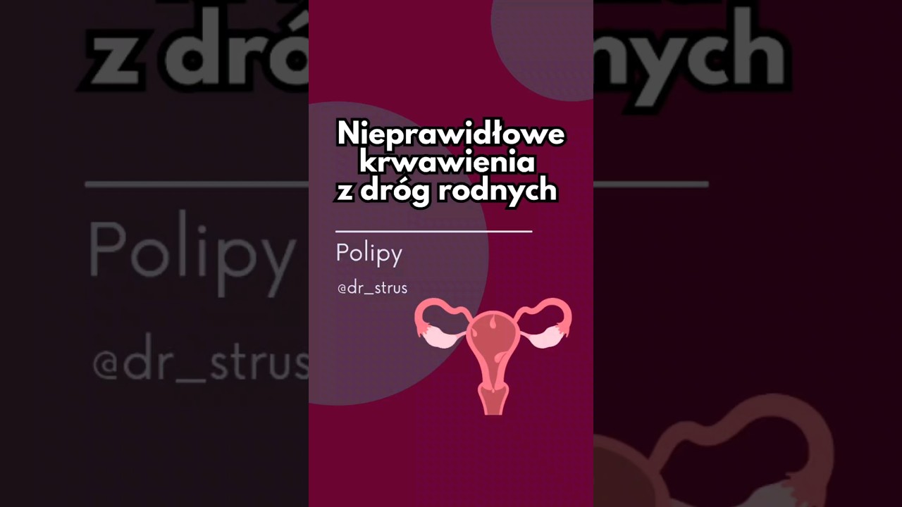 Polipy endometrium - jak je wykryć? #zdrowie #polipy #macica #krwawienie #ginekolog #dr_strus