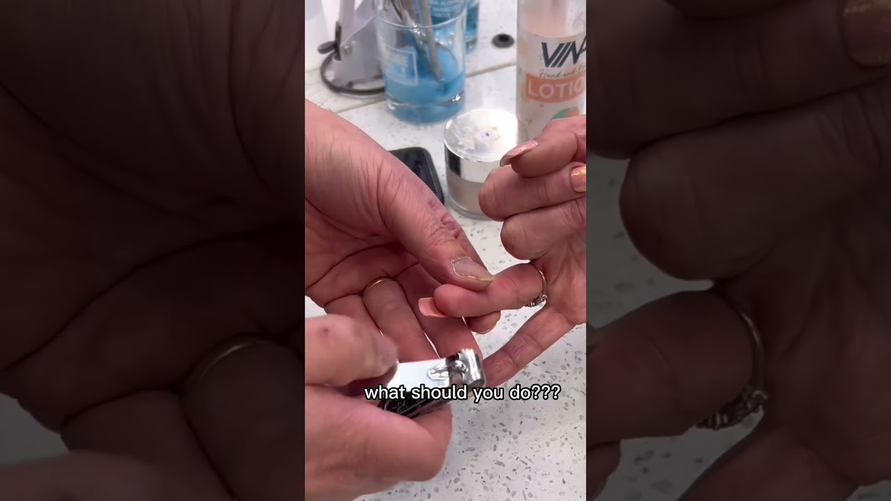 Acrylic Nail Ripped Off 