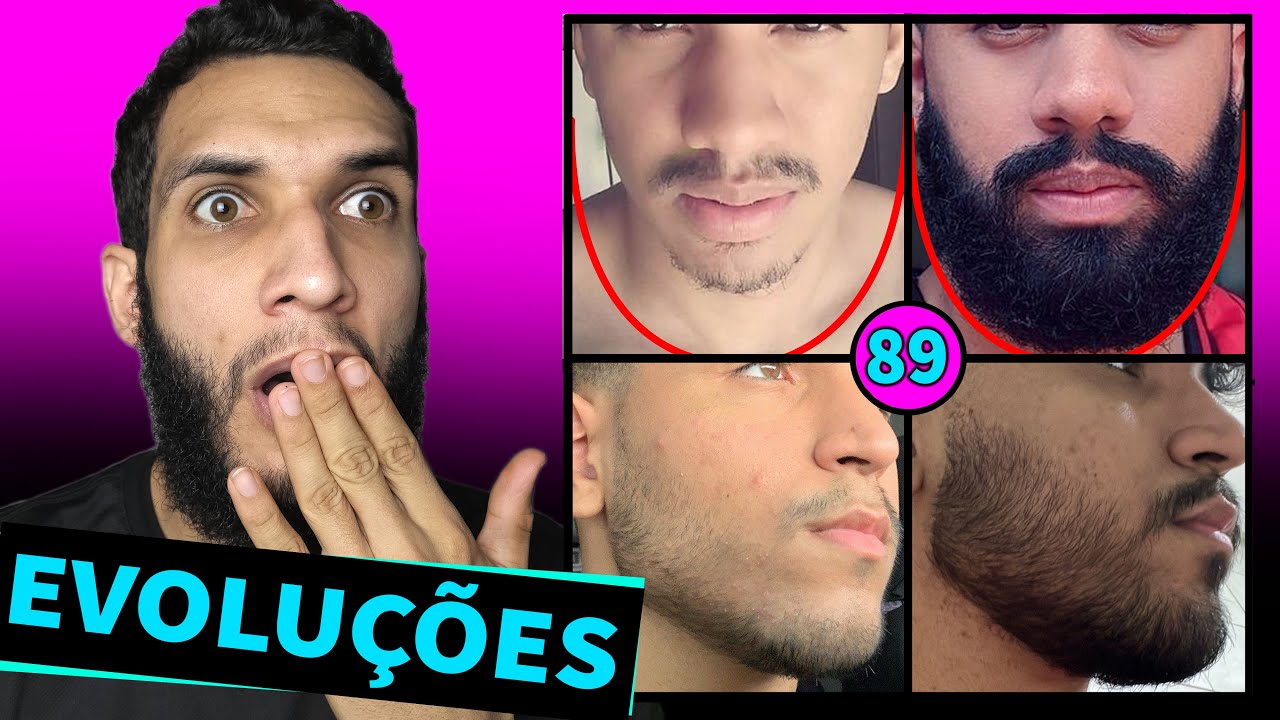 EVOLUÇÃO DOS INSCRITOS / MINOXIDIL #89