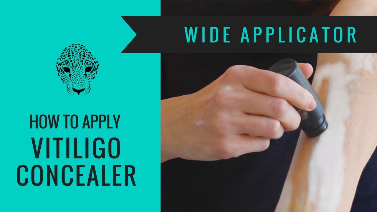 Vitiligo Makeup Guide  - Wide Applicator Tutorial - How to cover Vitiligo