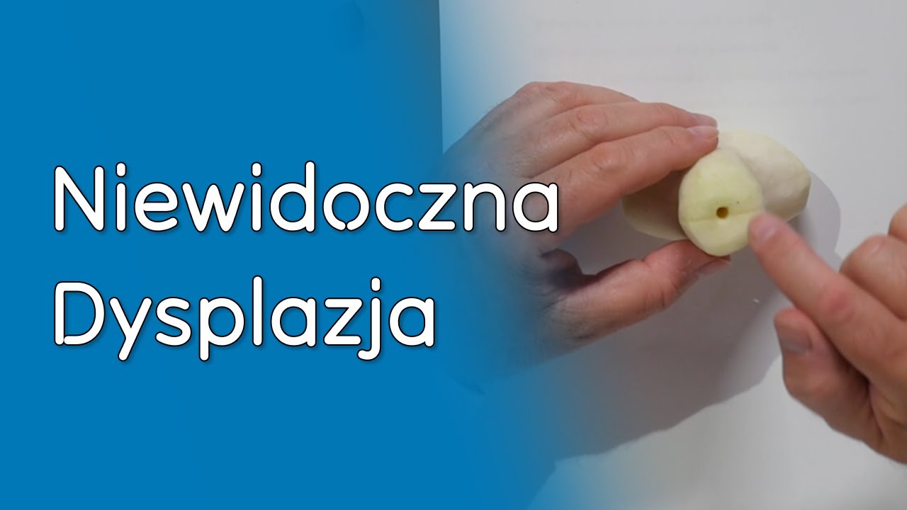 Co to jest dysplazja?