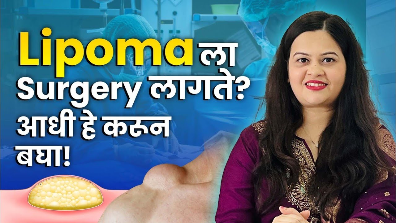Lipoma म्हणजे काय ? | Lipoma Ayurvedic Treatment| Ayurveda Expert - Dr. Rucha Mehendale Pai