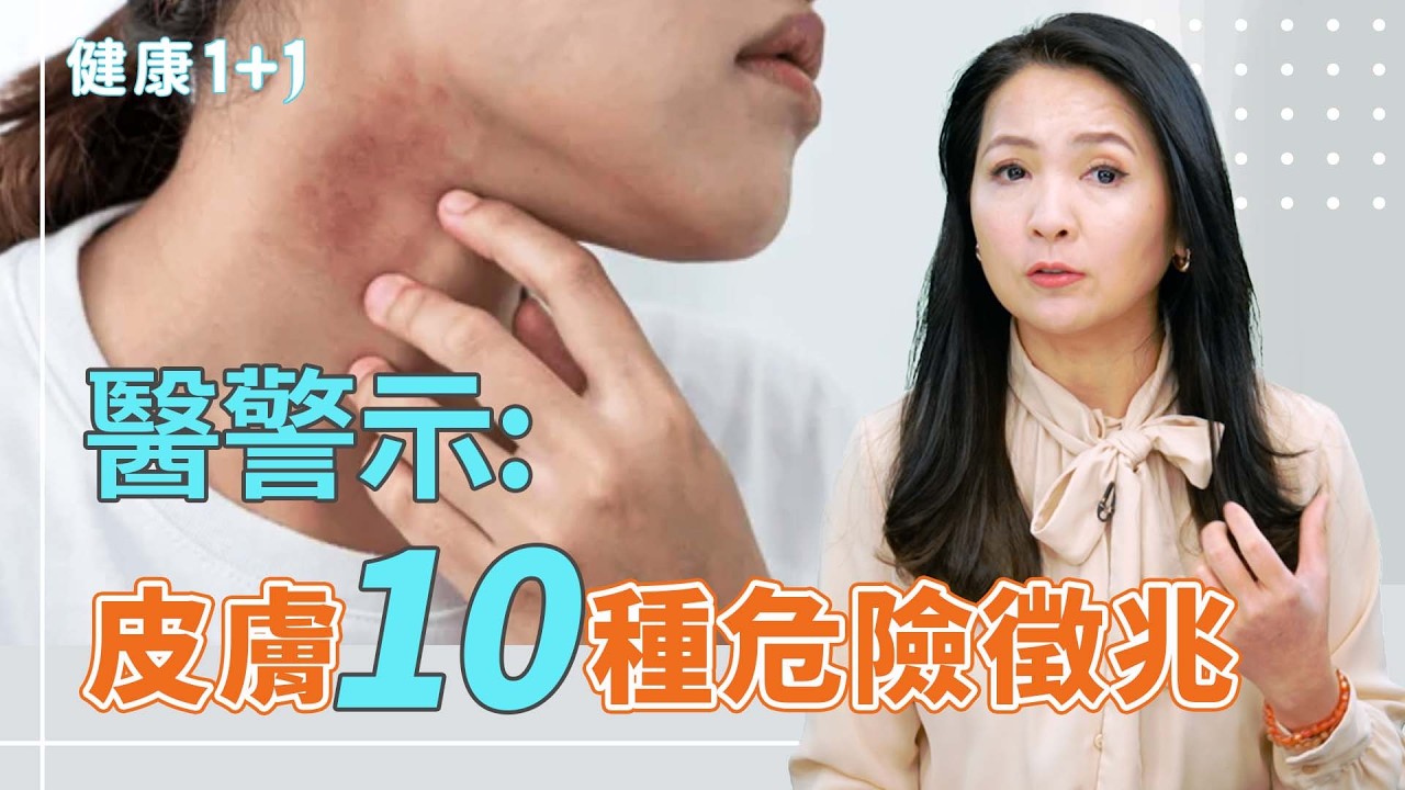 皮膚是健康「照妖鏡」！百萬網紅醫師揭：10種皮膚異常警訊，小心癌症、肝臟、糖尿病前兆！【JoJo健康咖｜健康1+1】