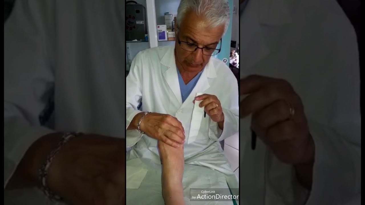 Immobilizzazione con cerotto per frattura dito dottore Lorenzo
