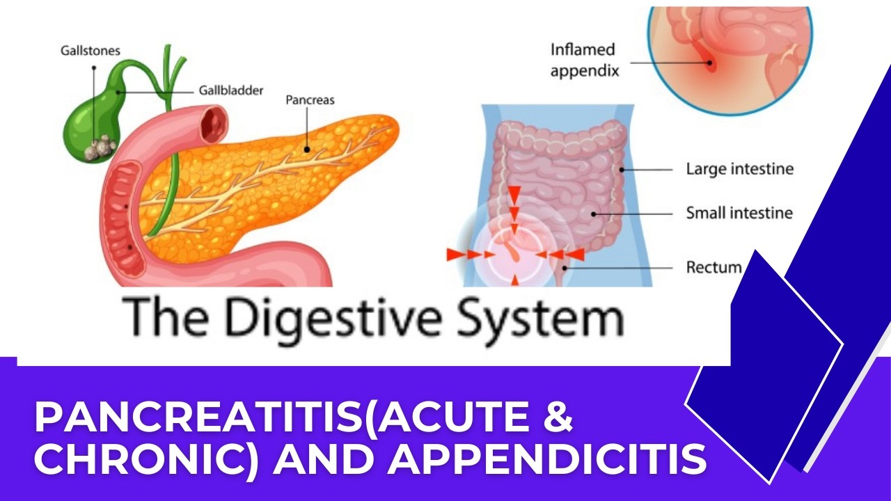 PANCREATITIS & APPENDICITIS SIMPLIFIED! KNOW THE CAUSES, NURSING INTERVENTIONS etc@EXCELLENTRN123