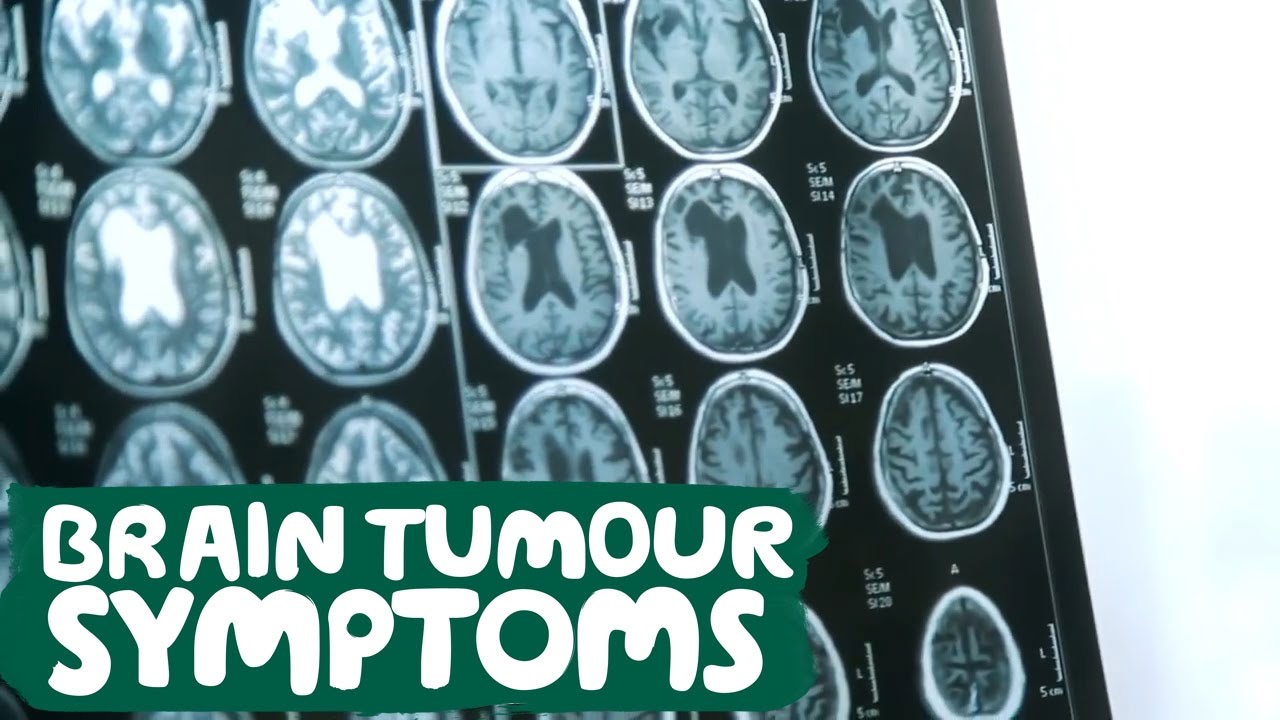 About Brain Tumour Symptoms - Macmillan Cancer Support
