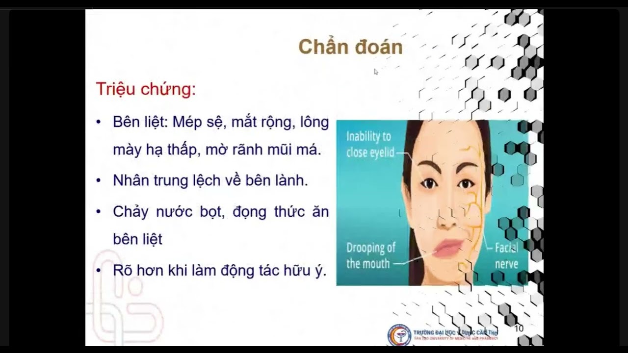 CKCB PHCN: PHỤC HỒI CHỨC NĂNG CHO BỆNH NH&Acirc;N LIỆT VII NGOẠI BI&Ecirc;N