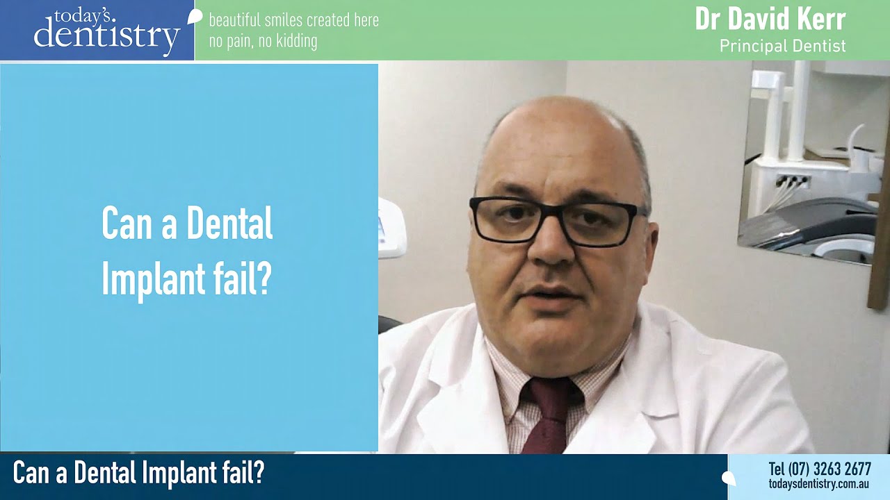 Can a Dental Implant fail and what are the reasons for implants failing?