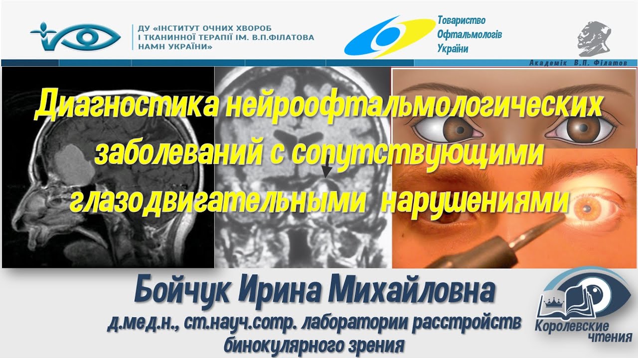 Диагностика нейроофтальмологических заболеваний с сопутствующими глазодвигательными  нарушениями